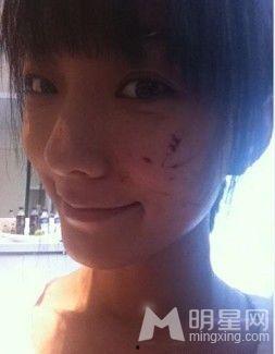 明星破相图,揭秘意外瞬间背后的故事